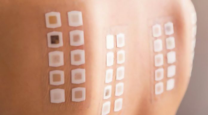 I fattori ambientali possono aumentare gli effetti di allergie e intolleranze